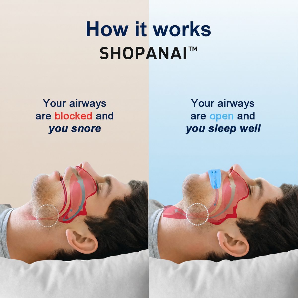 Giftsune™  Professional intelligent anti-snoring device